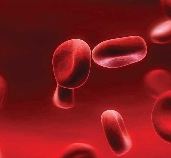 کم خونی و عادات بد غذایی