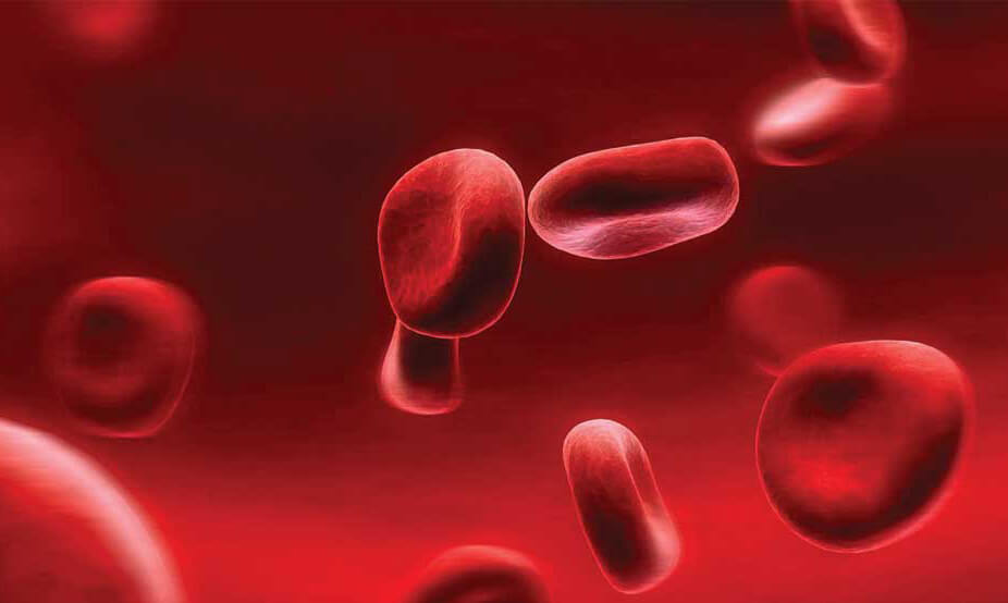 کم خونی و عادات بد غذایی